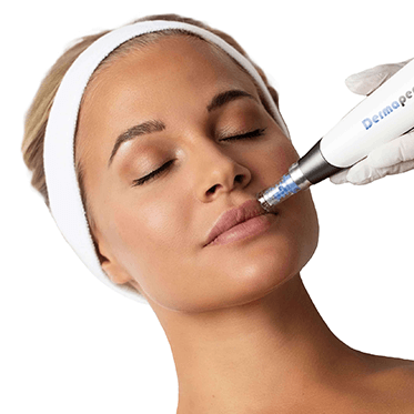 Microneedling Medical cu Dermapen 4 Rejuvenare faciala