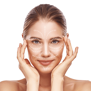 lifting fire Pdo lifting non-chirugical